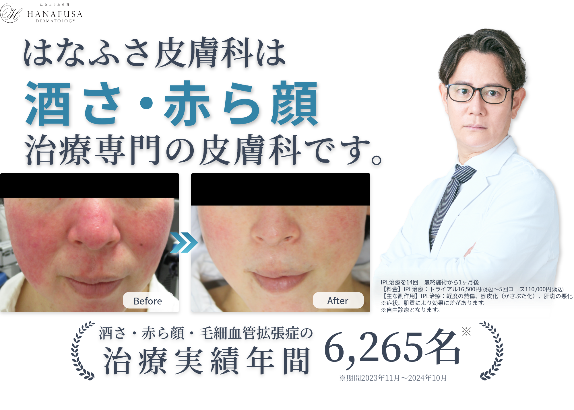 はなふさ皮膚科は酒さ・赤ら顔治療専門の皮膚科です